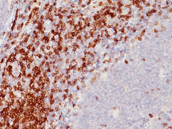 CD5 (Mantle Cell Lymphoma Marker) Antibody - With BSA and Azide