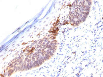 CD1a (Mature Langerhans Cells Marker) Antibody - With BSA and Azide