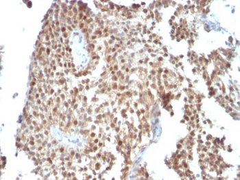 p53 Tumor Suppressor Protein Antibody - With BSA and Azide