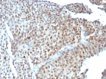 p53 Tumor Suppressor Protein Antibody - With BSA and Azide