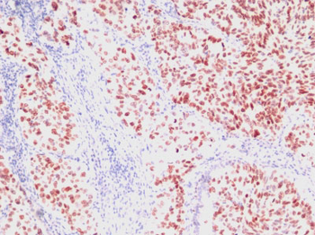 TTF-1 / NKX2.1 (Thyroid & Lung Epithelial Marker) Antibody - With BSA and Azide