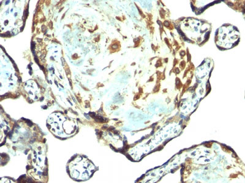 TIMP-3 (Tissue Inhibitor of Metalloproteinase-3) Antibody - With BSA and Azide