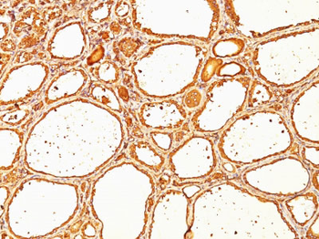 Thyroglobulin (Thyroidal Cell Marker) Antibody - With BSA and Azide