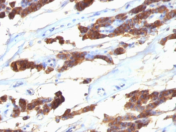 Thyroglobulin (Thyroidal Cell Marker) Antibody - With BSA and Azide
