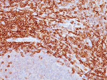 CD43 (T-Cell Marker) Antibody - With BSA and Azide