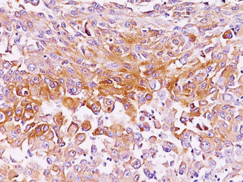 gp100 / Melanosome / PMEL17 / SILV (Melanoma Marker) Antibody - With BSA and Azide