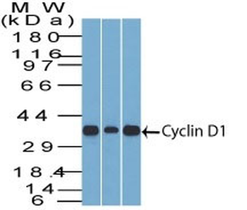 Cyclin D1 (G1-Cyclin & Mantle Cell Marker) Antibody - With BSA and Azide