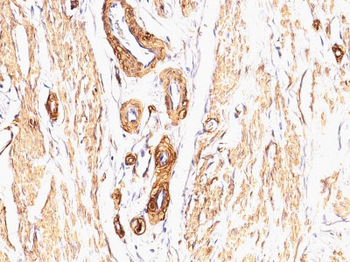 Actin, Smooth Muscle (Leiomyosarcoma Marker) Antibody - With BSA and Azide