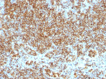 CD45 / LCA (Leucocyte Marker) Antibody - With BSA and Azide