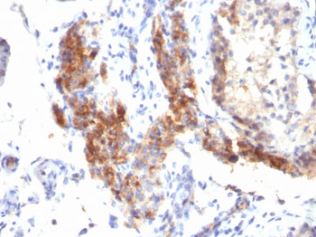 FOXP3 (Forkhead Box Protein P3) / Scurfin Antibody - With BSA and Azide