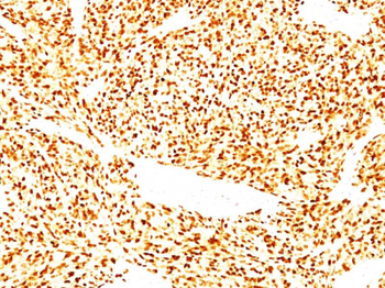 MyoD1 (Rhabdomyosarcoma Marker) Antibody - With BSA and Azide