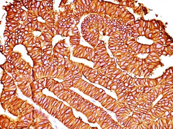Ep-CAM / CD326 (Epithelial Marker) Antibody - With BSA and Azide