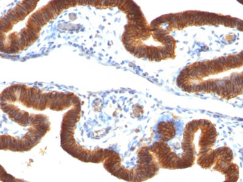 Ep-CAM / CD326 (Epithelial Marker) Antibody - With BSA and Azide