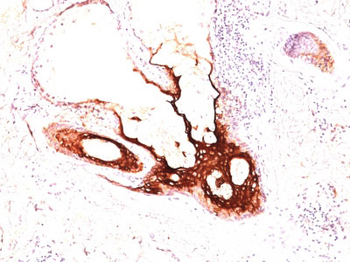 Cytokeratin 17 (KRT17) (Basal Epithelial Marker) Antibody - With BSA and Azide