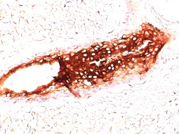Cytokeratin 17 (KRT17) (Basal Epithelial Marker) Antibody - With BSA and Azide
