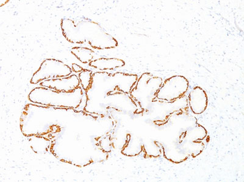 Cytokeratin 14 (KRT14) (Squamous Cell Marker) Antibody - With BSA and Azide