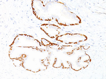 Cytokeratin 14 (KRT14) (Squamous Cell Marker) Antibody - With BSA and Azide