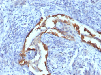 Cytokeratin 8 (KRT8) Antibody - With BSA and Azide