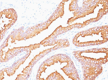 Prostate Specific Antigen (PSA) Antibody - With BSA and Azide