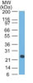 Lambda Light Chain (B-Cell Marker) Antibody - With BSA and Azide