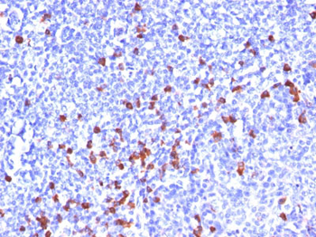 Kappa Light Chain (B-Cell Marker) Antibody - With BSA and Azide