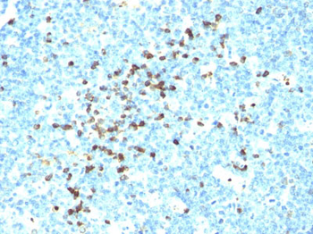 IgG (Immunoglobulin Gamma Heavy Chain) (B-Cell Marker) Antibody - With BSA and Azide