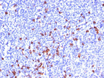 IgG (Immunoglobulin Gamma Heavy Chain) (B Cell Marker) Antibody - With BSA and Azide