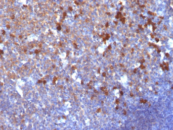 IgG (Immunoglobulin Gamma Heavy Chain) (B-Cell Marker) Antibody - With BSA and Azide