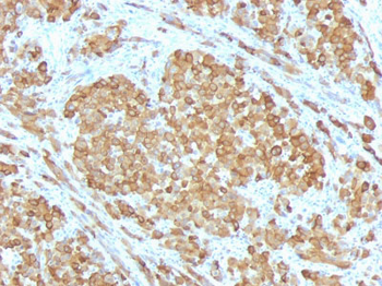 MART-1 / Melan-A / MLANA (Melanoma Marker) Antibody - With BSA and Azide