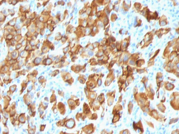 MART-1 / Melan-A / MLANA (Melanoma Marker) Antibody - With BSA and Azide