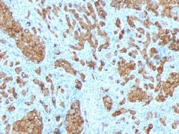 MART-1 / Melan-A / MLANA (Melanoma Marker) Antibody - With BSA and Azide