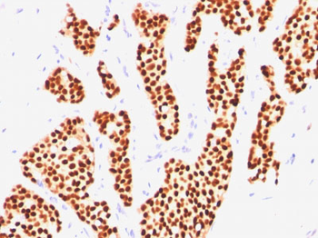 Estrogen Receptor (Marker of Estrogen Dependence) Antibody - With BSA and Azide