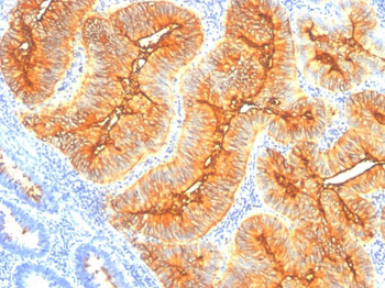 TAG-72 / CA72.4 (Tumor-Associated Glycoprotein) Antibody - With BSA and Azide
