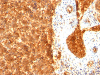 AFP (Alpha Fetoprotein) (Hepatocellular/Germ Cell Tumor Marker) Antibody - With BSA and Azide
