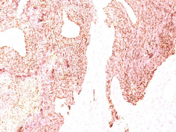 Chromogranin A / CHGA (Neuroendocrine Marker) Antibody - With BSA and Azide