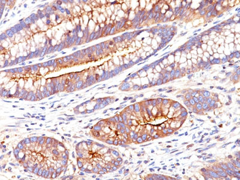 Carcinoembryonic Antigen (CEA) / CD66 Antibody - With BSA and Azide