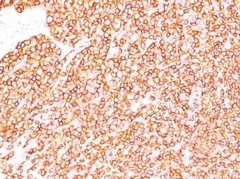 CD45RB Antibody [Clone BRA-11; same as BRA-11G]