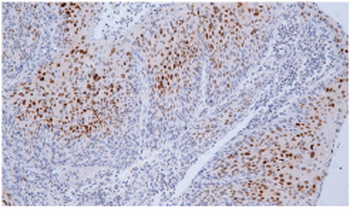 p21 Antibody