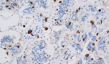 LH Antibody