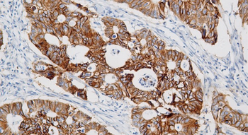 Cadherin 17 Antibody