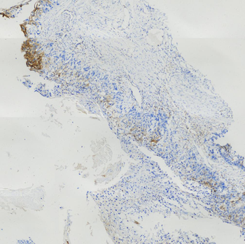 Nectin-4 Antibody