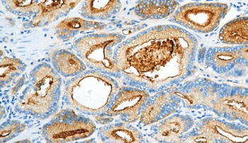 CD10 Antibody