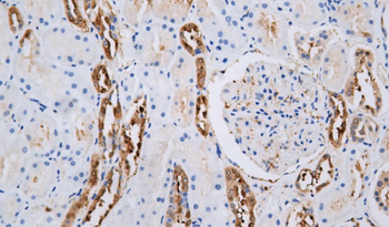 GST-π Antibody