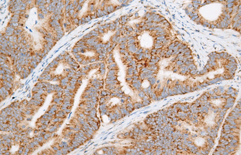 HGAL Antibody