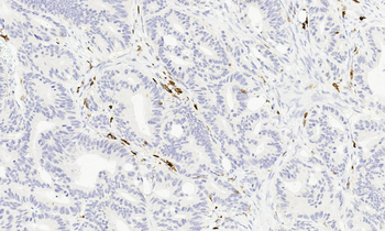 ICOS Antibody