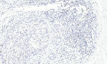 FoxP3 Antibody