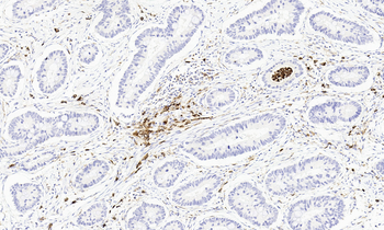 CD11b Antibody