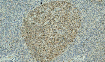 ER Antibody