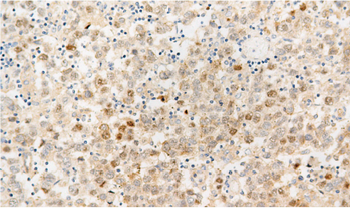 NUT Antibody