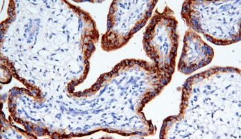 HCG Antibody